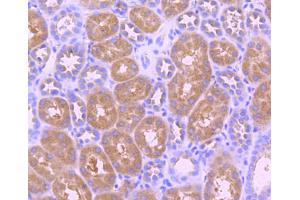 Immunohistochemistry (Paraffin-embedded Sections) (IHC (p)) image for anti-Neurotrophic Tyrosine Kinase, Receptor, Type 2 (NTRK2) (pTyr817) antibody (ABIN5557345)