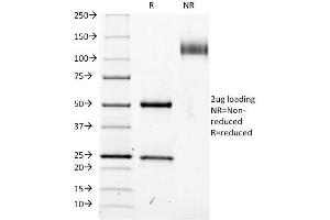 SDS-PAGE Analysis Purified CD25 Mouse Monoclonal Antibody (IL2RA/423). (CD25 抗体)