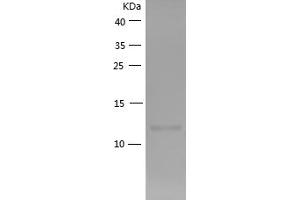 Western Blotting (WB) image for Chemokine (C-C Motif) Ligand 2 (CCL2) (AA 24-96) (Active) protein (His tag) (ABIN7122278)