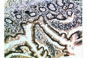 Immunohistochemical analysis of paraffin-embedded human-small-intestine, antibody was diluted at 1:200 (IL17B 抗体  (AA 1-50))