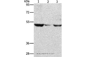 Western blot analysis of PC3 cell and mouse muscle tissue, A375 cell, using MMP1 Polyclonal Antibody at dilution of 1:500 (MMP1 抗体)