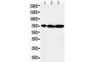 Anti-MEKK2 antibody, Western blotting Lane 1: Rat Brain Tissue Lysate Lane 2: Rat Testis Tissue Lysate Lane 3: Rat Lung Tissue Lysate (MAP3K2 抗体  (C-Term))
