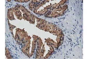 Image no. 1 for anti-Acetyl-CoA Acetyltransferase 2 (ACAT2) antibody (ABIN1496396) (ACAT2 抗体)