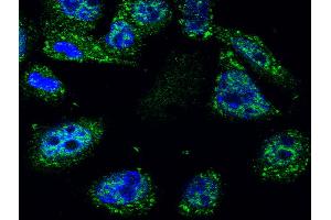 Image kindly submitted by Piotr Mamczur from Wroclaw University. (p53 抗体  (AA 251-310))