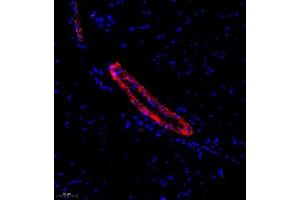 Immunofluorescence analysis of paraffin embedded rat skeletal muscle using ACTN1 (ABIN7072905) at dilution of 1: 500 (ACTN1 抗体)