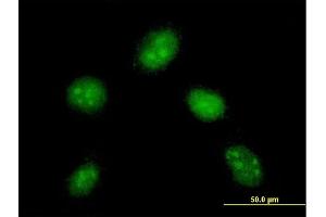 Immunofluorescence of monoclonal antibody to DYDC1 on HeLa cell. (DYDC1 抗体  (AA 1-177))