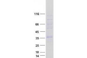 Western Blotting (WB) image for Gap Junction Protein, beta 4, 30.3kDa (GJB4) protein (Myc-DYKDDDDK Tag) (ABIN2721892)