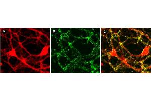 Immunocytochemistry (ICC) image for anti-Liprin alpha 3 (PPFIA3) (AA 463-604) antibody (ABIN1742356) (LIPA3 抗体  (AA 463-604))