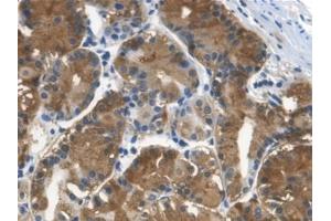 Detection of Cys-C in Human Stomach Tissue using Monoclonal Antibody to Cystatin C (Cys-C) (Cystathionine-gamma-Synthase Precursor (CYS) (AA 27-146) 抗体)