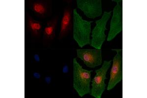ABIN6264196 and ABIN6266654 staining  cells by IF/ICC. (PIAS2 抗体  (N-Term))