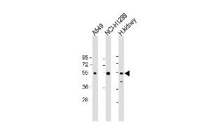 Western Blot at 1:2000 dilution Lane 1: A549 whole cell lysate Lane 2: NCI-H1299 whole cell lysate Lane 3: human kidney lysate Lysates/proteins at 20 ug per lane. (GCNT3 抗体  (N-Term))