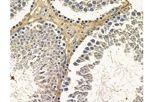 ABIN7096796 and ABIN7100862 at 1/100 staining rat testis tissue by IHC-P. (DHX37 抗体)