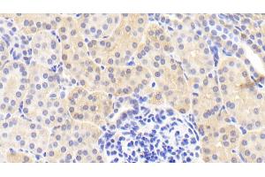 Immunohistochemistry (IHC) image for anti-Peroxiredoxin 6 (PRDX6) (AA 1-224) antibody (ABIN7436129)