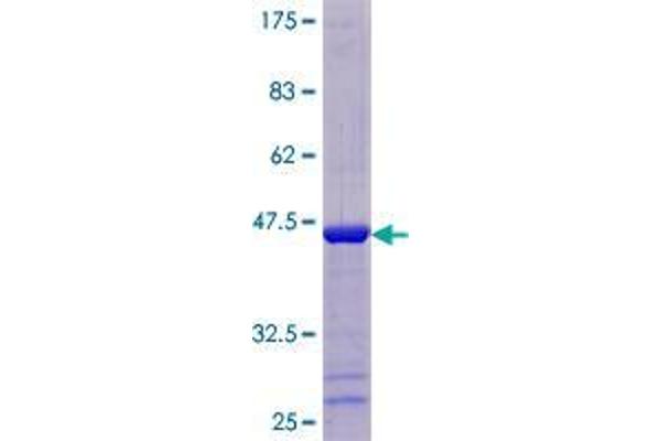 THEM2 Protein (AA 1-140) (GST tag)