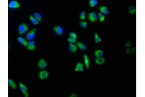 Immunofluorescence staining of Hela cells with ABIN7159477 at 1:50, counter-stained with DAPI. (TRABD2B 抗体  (AA 195-405))