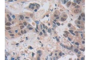 Immunohistochemistry (IHC) image for anti-Nucleoporin 50kDa (NUP50) (AA 37-269) antibody (ABIN7442900)