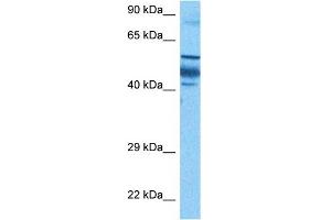 Host:  Rabbit  Target Name:  ZNF519  Sample Tissue:  Human Gallbladder Tumor lysates  Antibody Dilution:  1ug/ml (ZNF519 抗体  (N-Term))