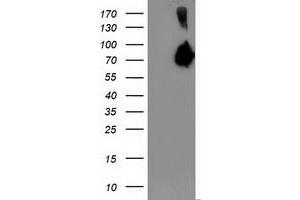 Western Blotting (WB) image for anti-Asparagine Synthetase (ASNS) antibody (ABIN1496750) (Asparagine Synthetase 抗体)