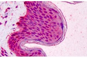 Human Skin: Formalin-Fixed, Paraffin-Embedded (FFPE) (RAD51 抗体)