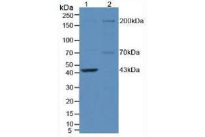 Western blot analysis of (1) Mouse Brain Tissue and (2) Mouse Testis Tissue. (NOS1 抗体  (AA 1199-1399))