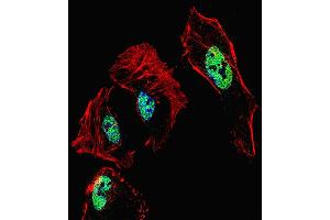 Fluorescent confocal image of Hela cell stained with RARB Antibody . (Retinoic Acid Receptor beta 抗体  (AA 168-195))