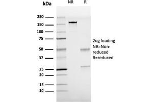 SDS-PAGE Analysis Purified TTF-1 Mouse Recombinant Monoclonal Antibody (rNX2. (Recombinant NKX2-1 抗体)