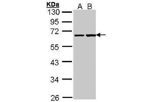 WB Image Sample (30 ug of whole cell lysate) A: A431 , B: H1299 10% SDS PAGE antibody diluted at 1:1000 (PHF1 抗体)
