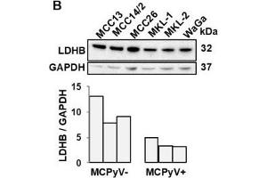 LDHB is inversely correlated with miR-375 in MCC tumors and cell lines. (LDHB 抗体  (AA 1-334))