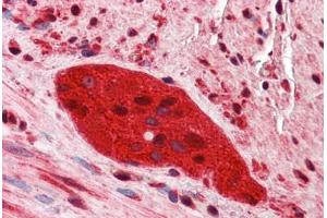 Human Small Intestine, Myenteric Plexus: Formalin-Fixed, Paraffin-Embedded (FFPE) (ZEB2 抗体  (C-Term))