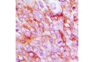 Immunohistochemistry (IHC) image for anti-Prostaglandin E Receptor 2 (Subtype EP2), 53kDa (PTGER2) (C-Term) antibody (ABIN7303840)