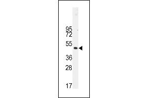 Western blot analysis of anti-Desmin Antibody (t16) (ABIN389226 and ABIN2839379) in NCI- cell line lysates (35 μg/lane). (Desmin 抗体  (AA 1-30))