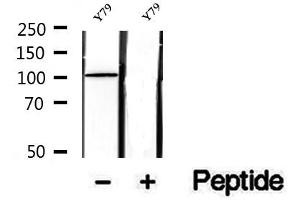 Western blot analysis of extracts of Y79 cells, using SFPQ antibody. (SFPQ 抗体  (C-Term))