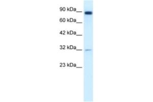 Western Blotting (WB) image for anti-Matrix Metallopeptidase 9 (Gelatinase B, 92kDa Gelatinase, 92kDa Type IV Collagenase) (MMP9) antibody (ABIN2460650) (MMP 9 抗体)