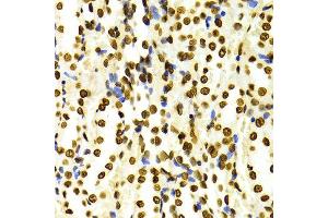 Immunohistochemistry of paraffin-embedded Rat kidney using H3K27me2 antibody at dilution of 1:100 (x400 lens). (Histone 3 抗体  (H3K27me))
