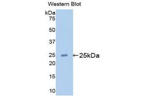 Western blot analysis of the recombinant protein. (Apolipoprotein M 抗体  (AA 20-190))
