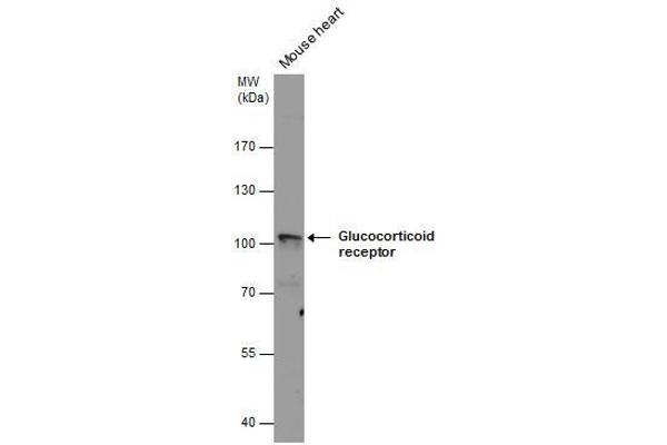 Glucocorticoid Receptor 抗体  (N-Term)