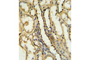 TR Antibody (N-term) 6545a IHC analysis in formalin fixed and paraffin embedded human kidney tissue followed by peroxidase conjugation of the secondary antibody and DAB staining. (CD40 Ligand 抗体  (N-Term))