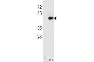 Western blot analysis of CD4 antibody and 293 cell lysate (2 ug/lane) either nontransfected (Lane 1) or transiently transfected with the CD4 gene (2). (CD4 抗体  (AA 58-86))