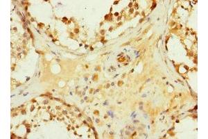 Immunohistochemistry of paraffin-embedded human testis tissue using ABIN7154932 at dilution of 1:100 (HHIP 抗体  (AA 18-220))