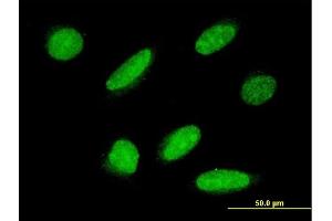 Immunofluorescence of monoclonal antibody to RPAP3 on HeLa cell.