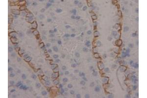 DAB staining on IHC-P; Samples: Rat Kidney Tissue