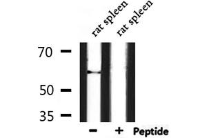 Western blot analysis of extracts from rat spleen, using Phospho-HDAC2 (Ser394) Antibody. (HDAC2 抗体  (pSer394))