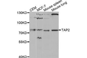 Western blot analysis of extracts of various cell lines, using TAP2 antibody (ABIN5970782) at 1/1000 dilution. (TAP2 抗体)