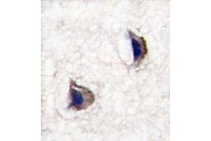 Formalin-fixed and paraffin-embedded human brain tissue reacted with NP1 (Nptx1) Antibody (Center) , which was peroxidase-conjugated to the secondary antibody, followed by DAB staining. (NPX1 抗体  (Middle Region))