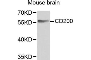 Western blot analysis of extracts of various cell lines, using CD200 antibody. (CD200 抗体  (AA 30-240))