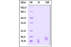 SDS-PAGE (SDS) image for Tumor Necrosis Factor Receptor Superfamily, Member 17 (TNFRSF17) (AA 1-54) (Active) protein (His tag) (ABIN4949075)