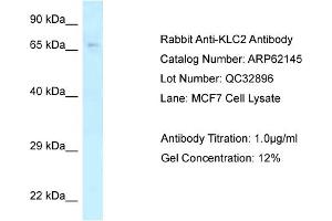 Western Blotting (WB) image for anti-Kinesin Light Chain 2 (KLC2) (C-Term) antibody (ABIN2789036) (KLC2 抗体  (C-Term))