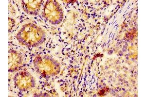 Immunohistochemistry (IHC) image for anti-Epidermal Growth Factor Receptor Pathway Substrate 8 (EPS8) (AA 572-670) antibody (ABIN7151882)