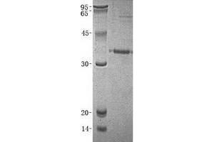 Validation with Western Blot (Prostate Specific Antigen Protein (PSA) (Transcript Variant 3) (His tag))
