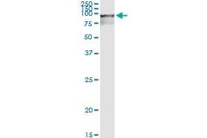 Immunoprecipitation of RBM5 transfected lysate using anti-RBM5 MaxPab rabbit polyclonal antibody and Protein A Magnetic Bead , and immunoblotted with RBM5 purified MaxPab mouse polyclonal antibody (B01P) .